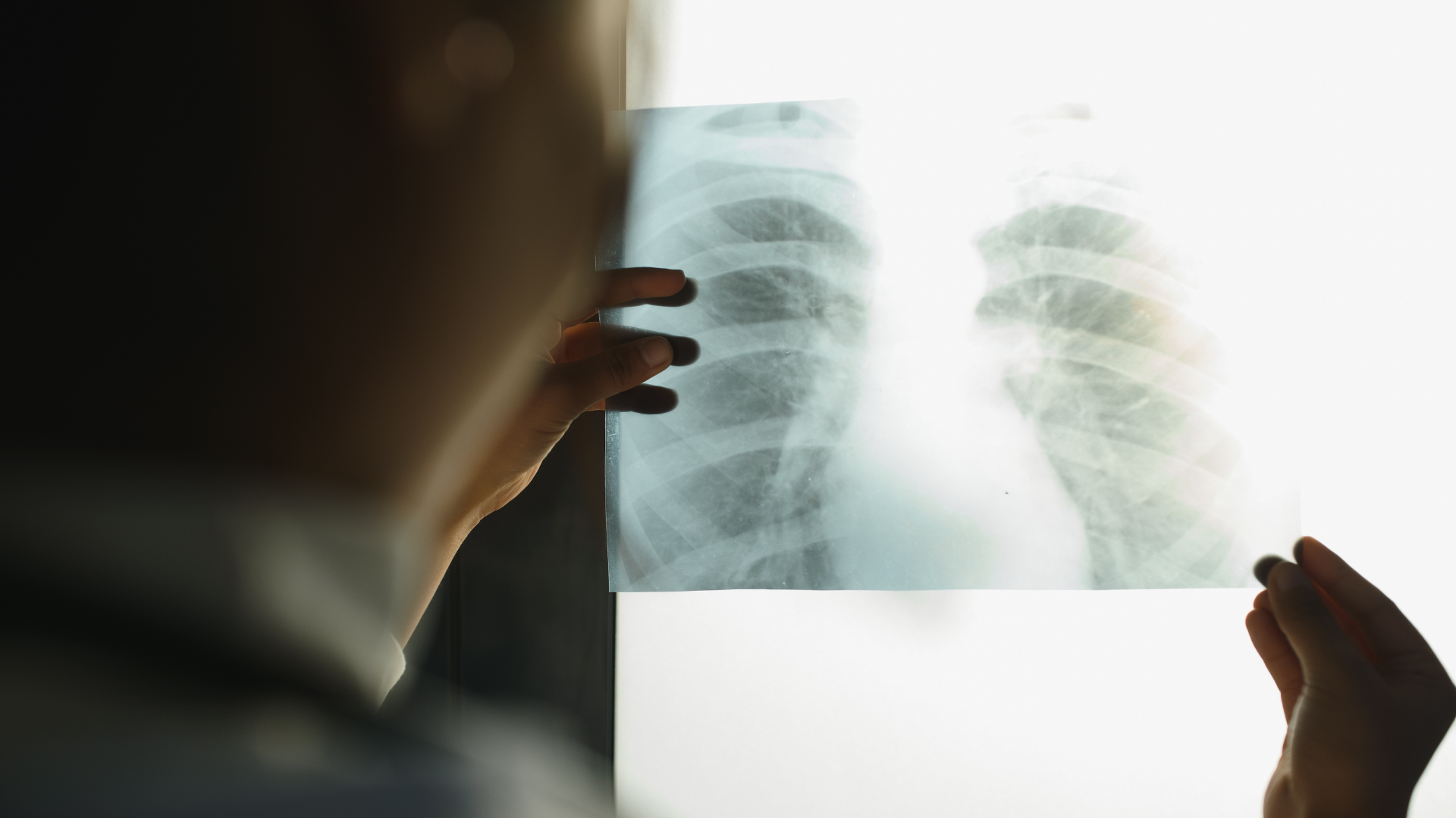 Kenali-5 Perbedaan-ISPA-vs-Pneumonia-Sebelum-Terlambat